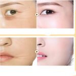 Absorbable Face Filler with Collagen – Deep Hydration - Image 5