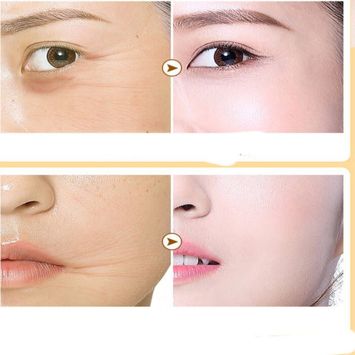 Absorbable Face Filler with Collagen – Deep Hydration - Image 5
