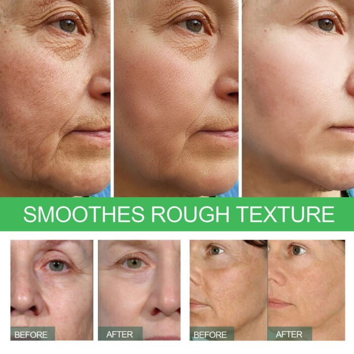 Anti-Wrinkle Face Serum – Deep Tightening & Brightening - Image 6