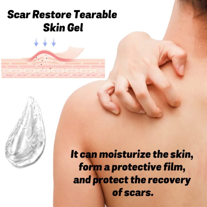 scar care gel
