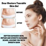 scar care gel