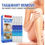 Filiform Wart Remover – Safe Mole & Wart Treatment - Image 6