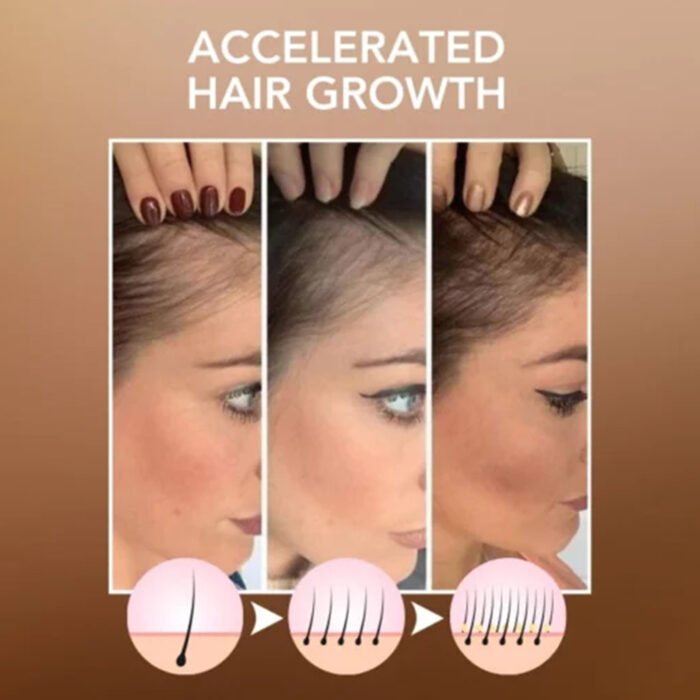 Moroccan Hair Care Oil - 100ml Nourishing Treatment - Image 2